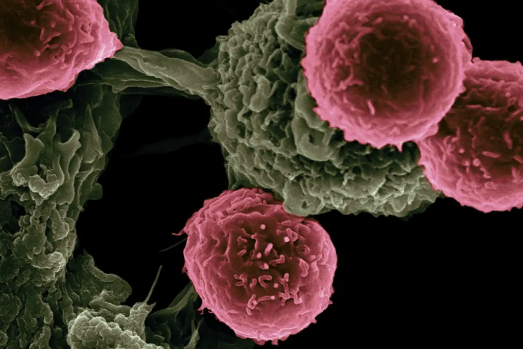 Cancer cells on a microscope.