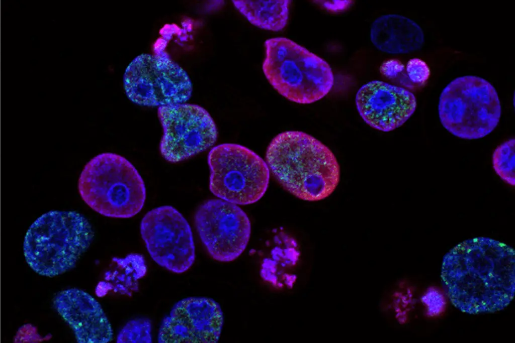 A microscopic image of cells stained with different colors.