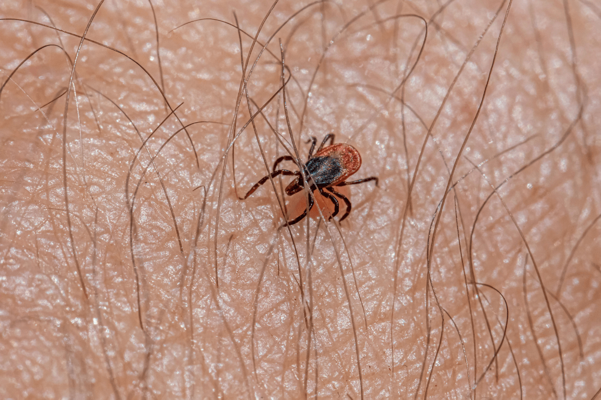 Close up of a tick on human skin.