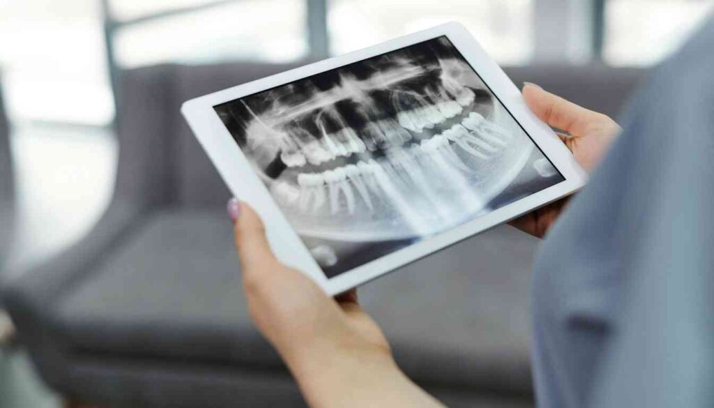 A dental X-ray displayed on a tablet held by hands, showing detailed upper and lower teeth structure.