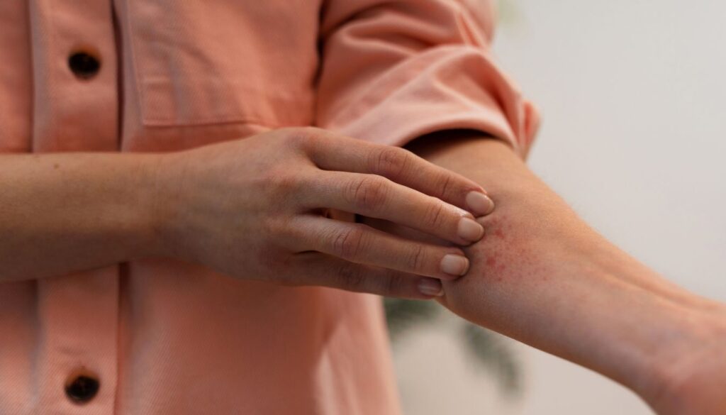 A person scratching a red, irritated rash on their forearm.