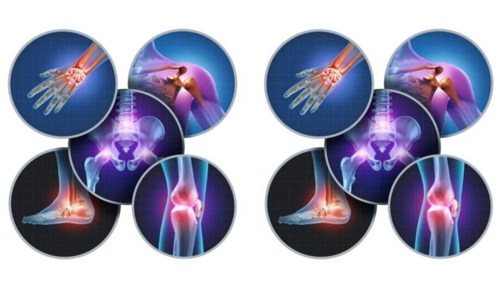Medical illustrations of inflamed joints including wrist, shoulder, hip, knee, and ankle.